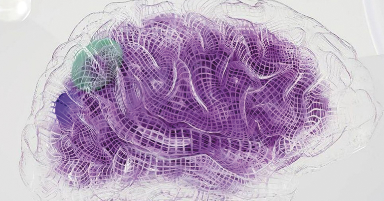 Investigadores de la Universidad de Canadá presentan un estudio sobre microplásticos en el tejido cerebral